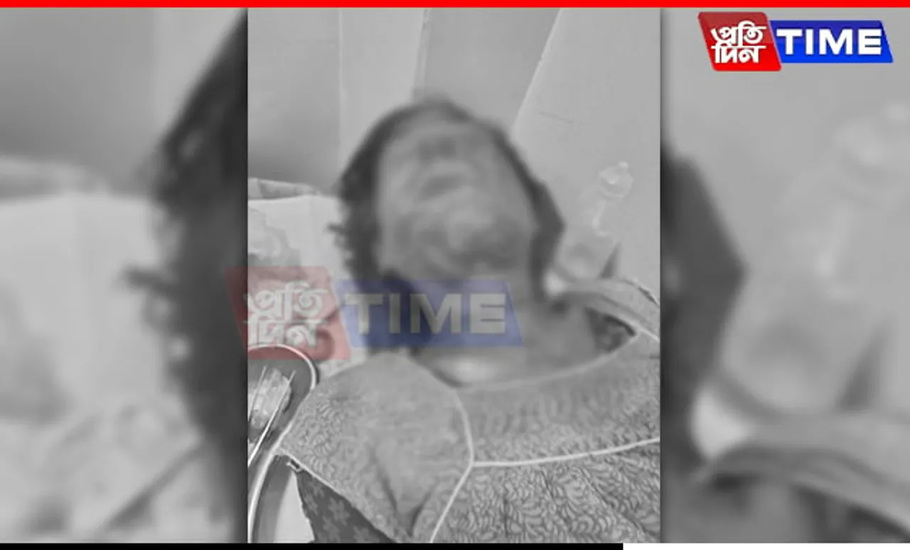 Woman Mauled By Leopard In Guwahati